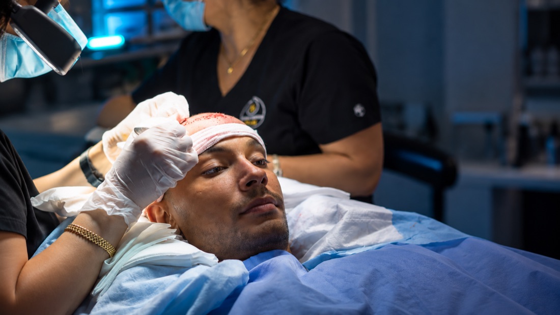 Nova Medical team member using an implanter pen to set grafts along a hairline during a DHI hair transplant in Nashville, Tennessee
