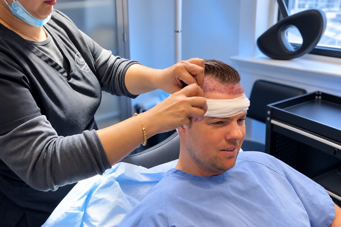 FUE hair transplant at Nova Medical Tennessee