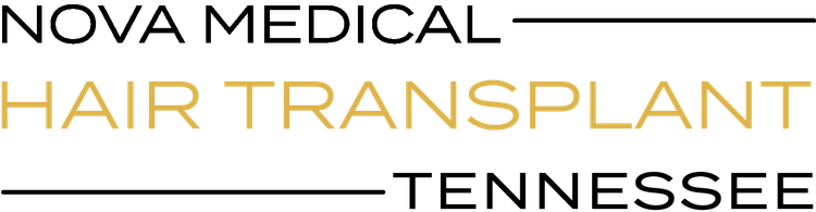 Hair Transplant Tennessee